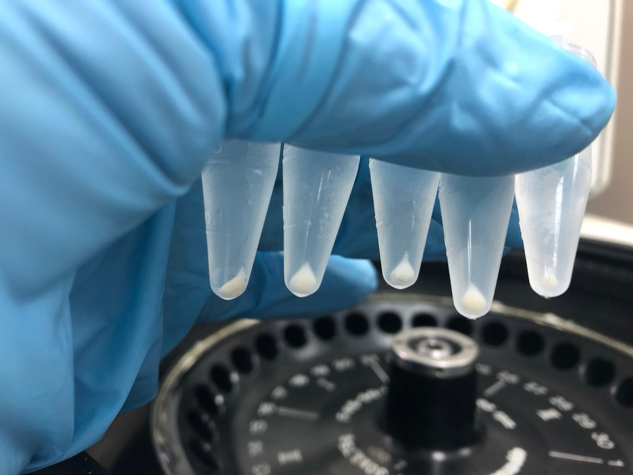 Nucleic Acid Extraction