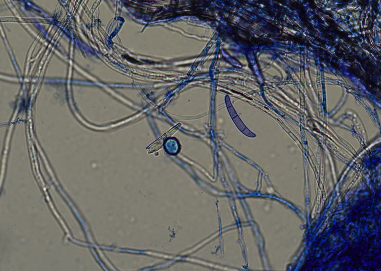 Pathogen Detection & Microbiology